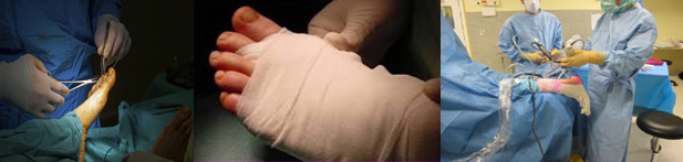 pied_chirurgie